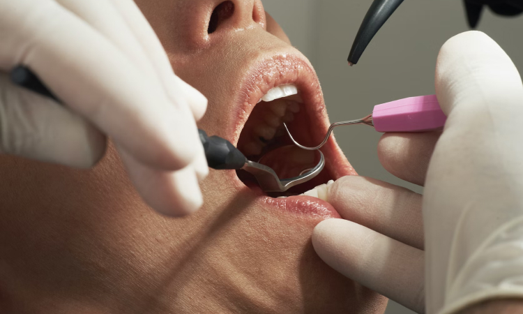 Dental Implants Work With Dentures
