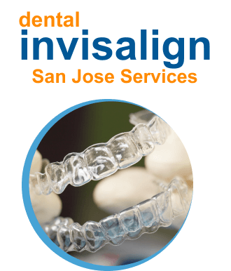 dental-invisalign-sanjose-service-1-_1_