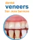 dental-veneers-sanjose-service-1-_1_