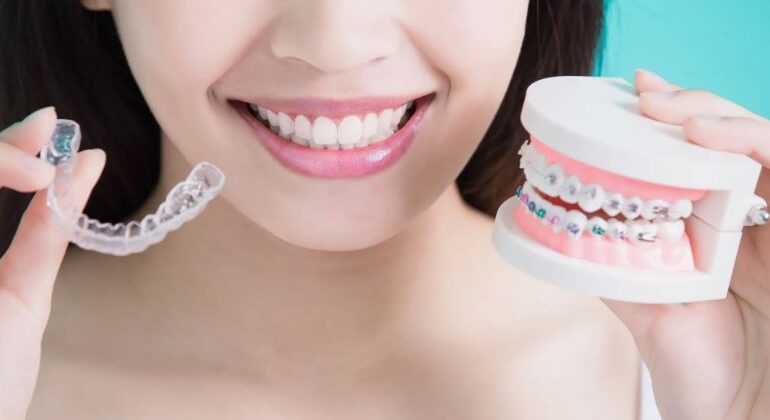 Orthodontic Treatment