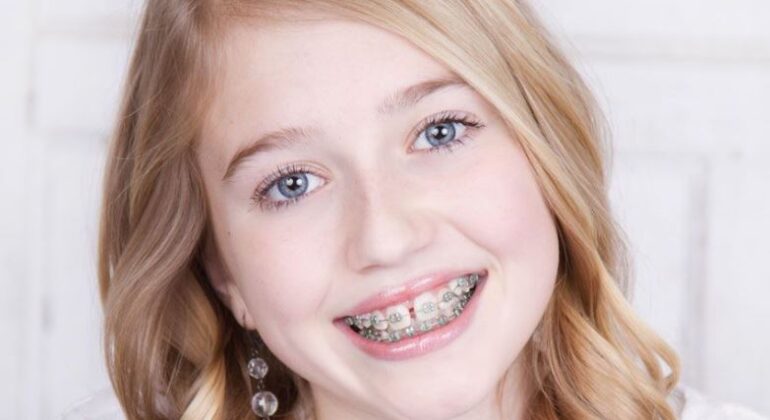 braces for teens