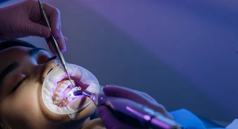 Getting Braces as an Adult