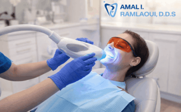 Teeth Whitening_RDDS