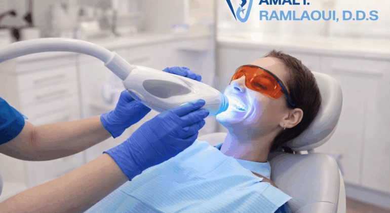 Teeth Whitening_RDDS