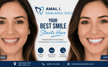 smile makeover