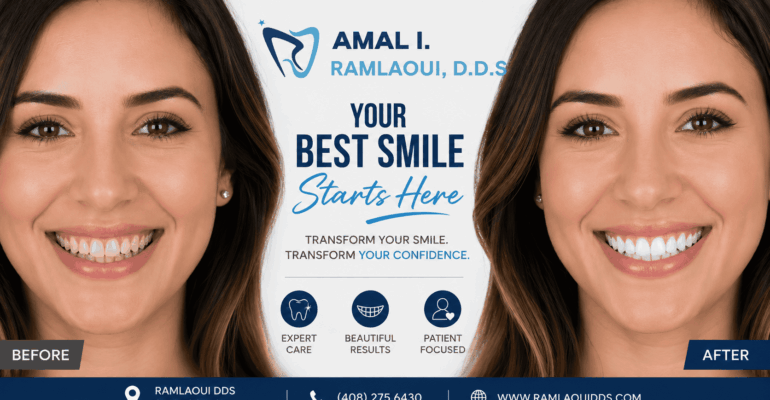 smile makeover